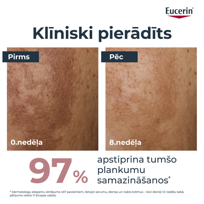 Eucerin Anti-Pigment divkāršas iedarbības serums sejai hiperpigmentācijas mazināšanai, 30 ml