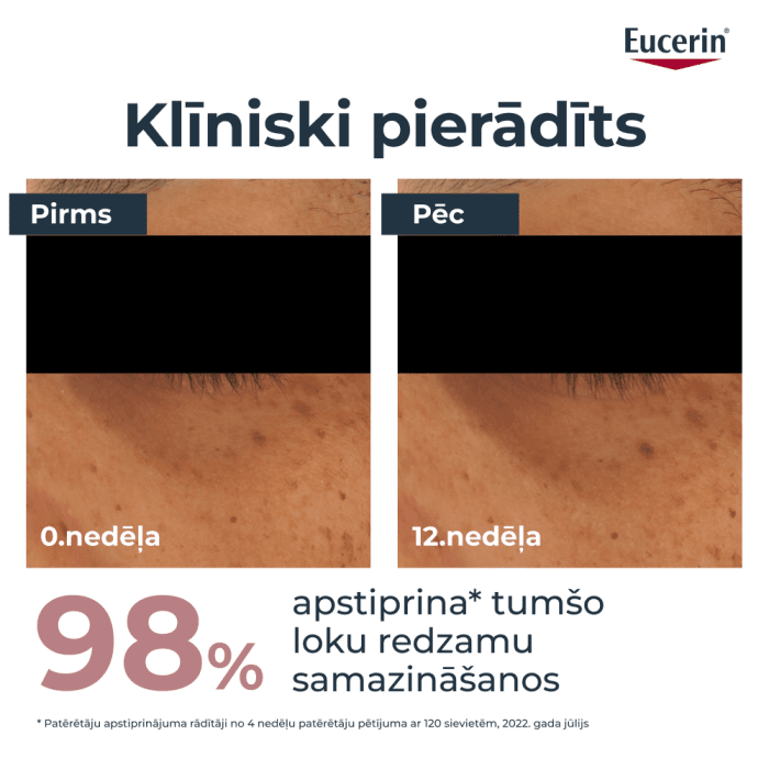 Eucerin Anti-Pigment acu krēms tumšo loku mazināšanai, 15 ml