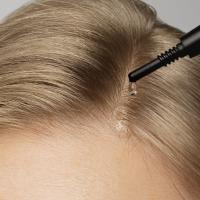 MADARA Scalp pīlinga serums galvas ādai 50ml