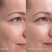 MADARA Kojic Alternative Pigment serums 30ml