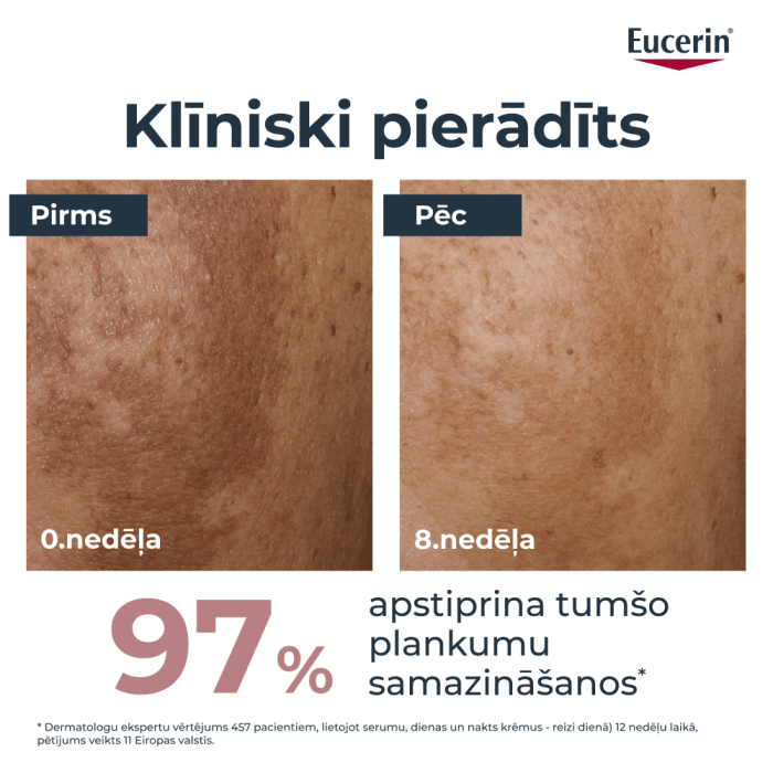 Eucerin Anti-Pigment divkāršas iedarbības serums sejai hiperpigmentācijas mazināšanai, 30 ml
