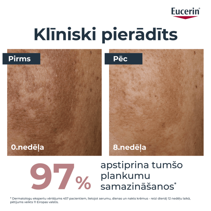 EUCERIN ANTI-PIGMENT divkāršas iedarbības serums 30 ml