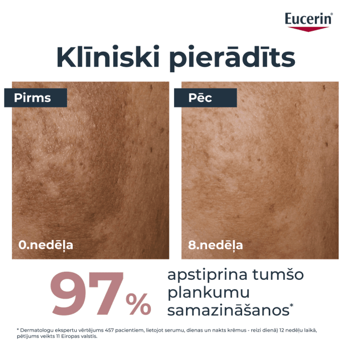 Eucerin Anti-Pigment divkāršas iedarbības serums sejai hiperpigmentācijas mazināšanai, 30 ml