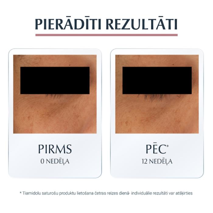 EUCERIN Anti-Pigment acu krēms tumšo loku mazināšanai 15 ml