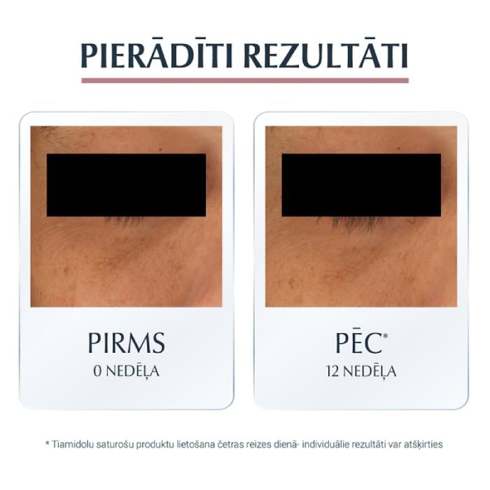 EUCERIN Anti-Pigment acu krēms tumšo loku mazināšanai 15 ml