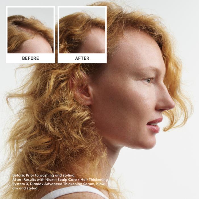 NIOXIN System 4 krāsotiem matiem ar progresējošu tendenci kļūt plānākiem, komplekts 300ml+300ml+100ml