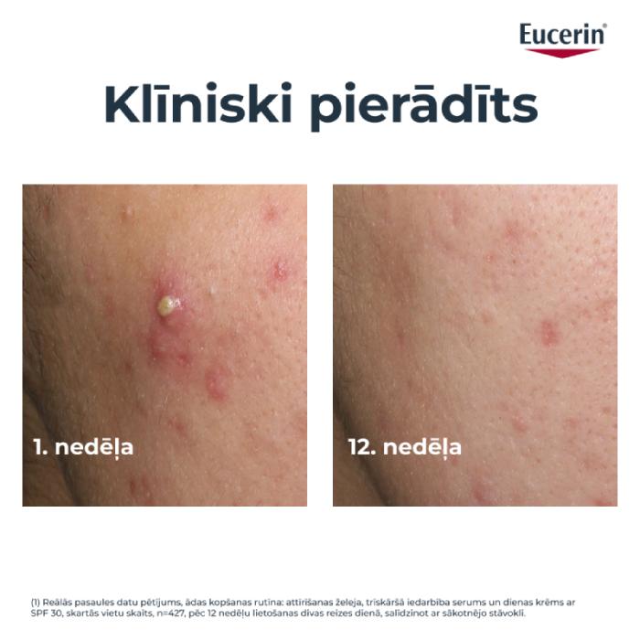 EUCERIN DermoPure Clinical trīskāršas iedarbības koriģējošs fluīds 40 ml