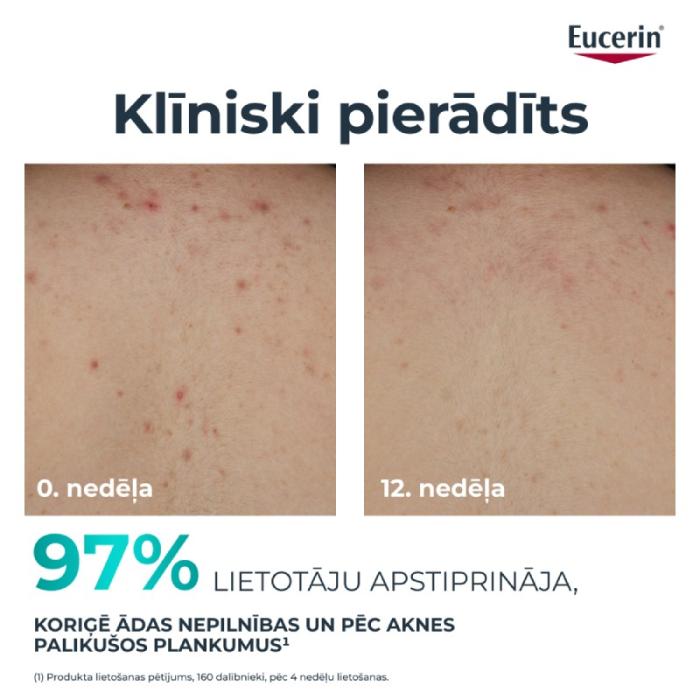 EUCERIN DermoPure Clinical koriģējošs ķermeņa krēms 200 ml